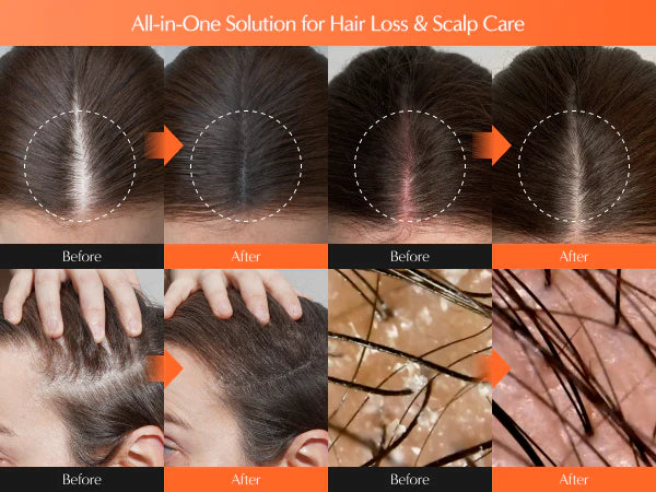 Lilyeve Growturn Hair Serum with Brush