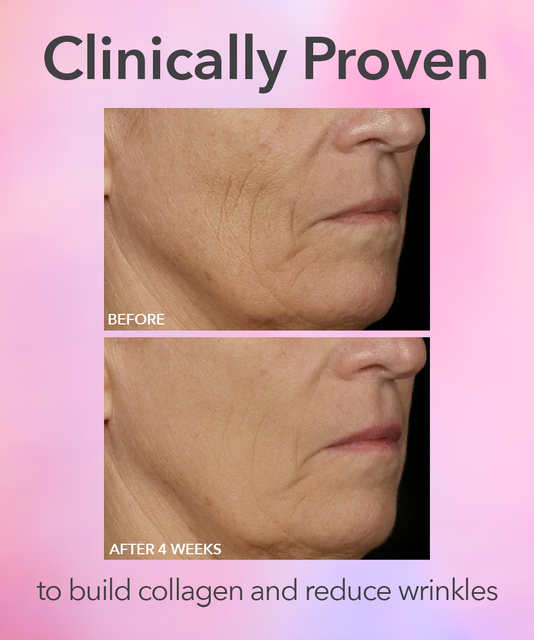 Dr. Dennis Gross DRx SpectraLite™ FaceWare Pro