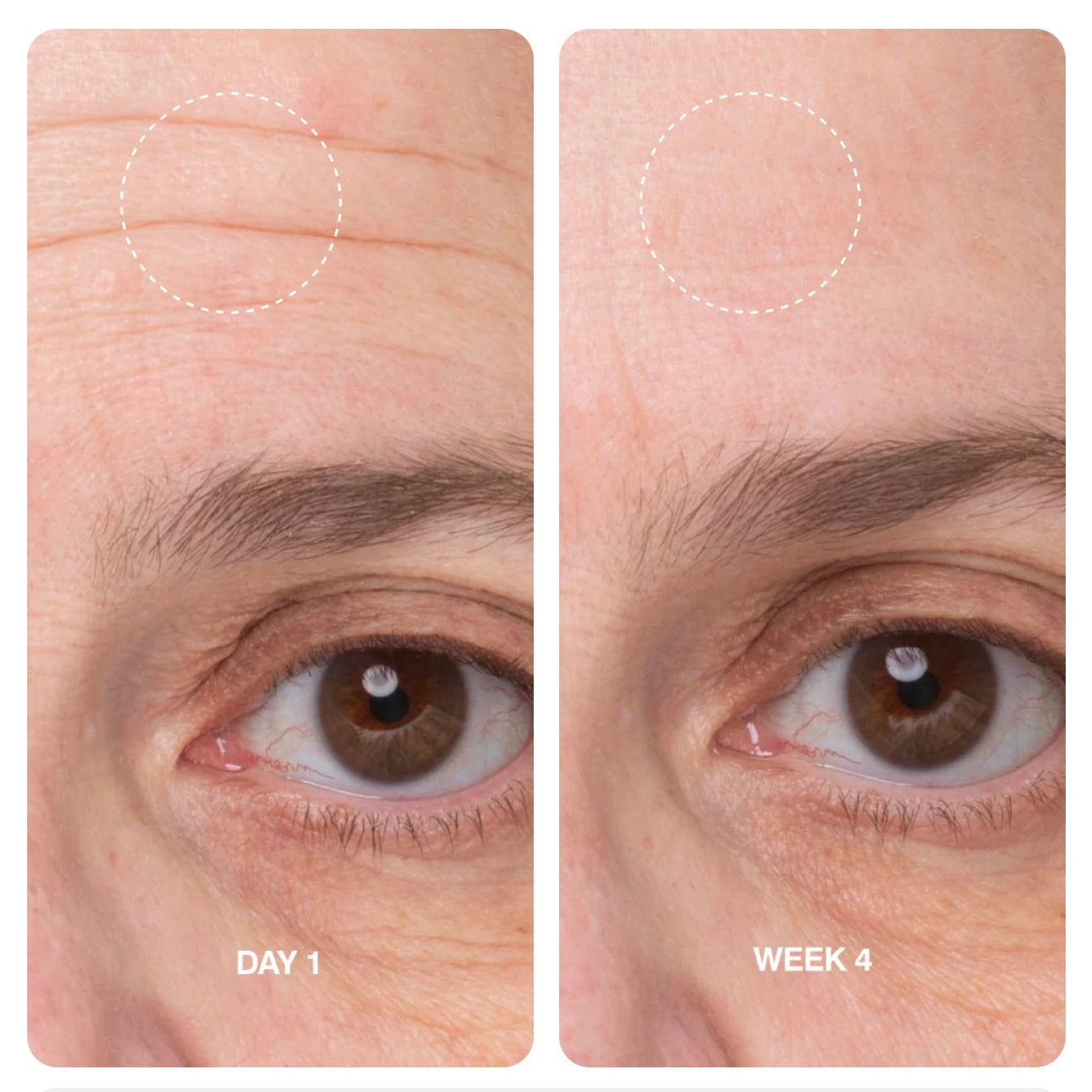 Barrier Butter - 100ml