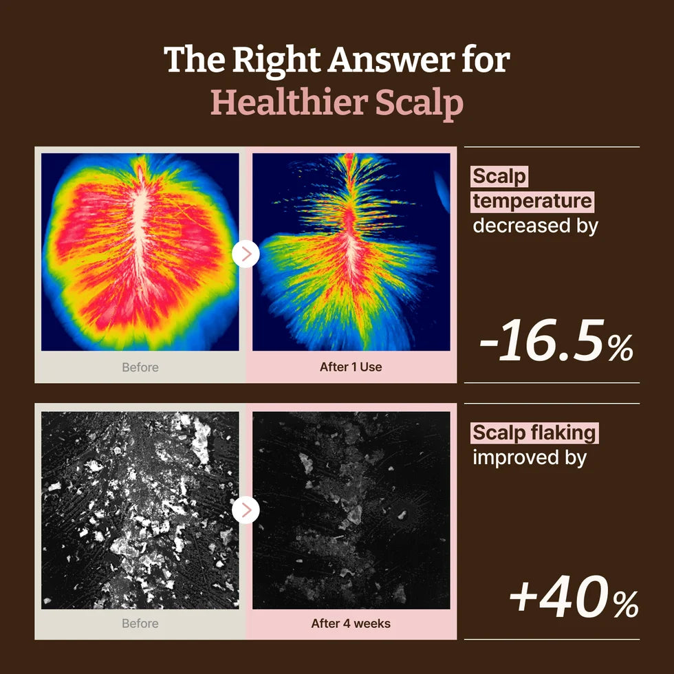 Dr. Reju-All Advanced PDRN Hair Density Scalp Serum