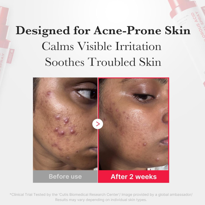 Medicube - Hypochlorous Acid Daily Facial Spray