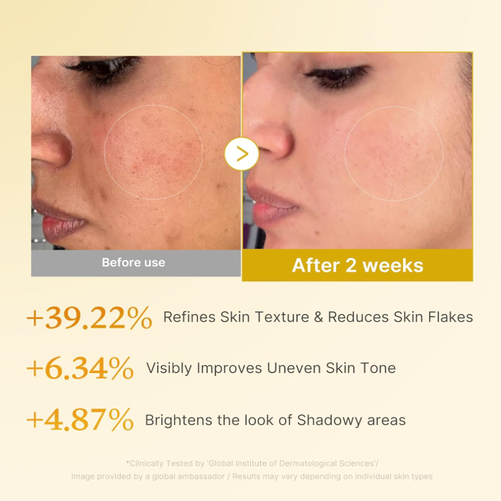 Medicube - Kojic Acid Turmeric Resurfacing Toner (250ml)