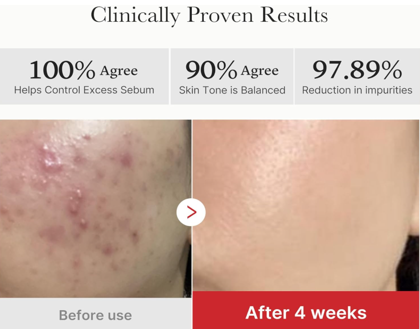 Medicube - Red Succinic Acid Peeling Pad