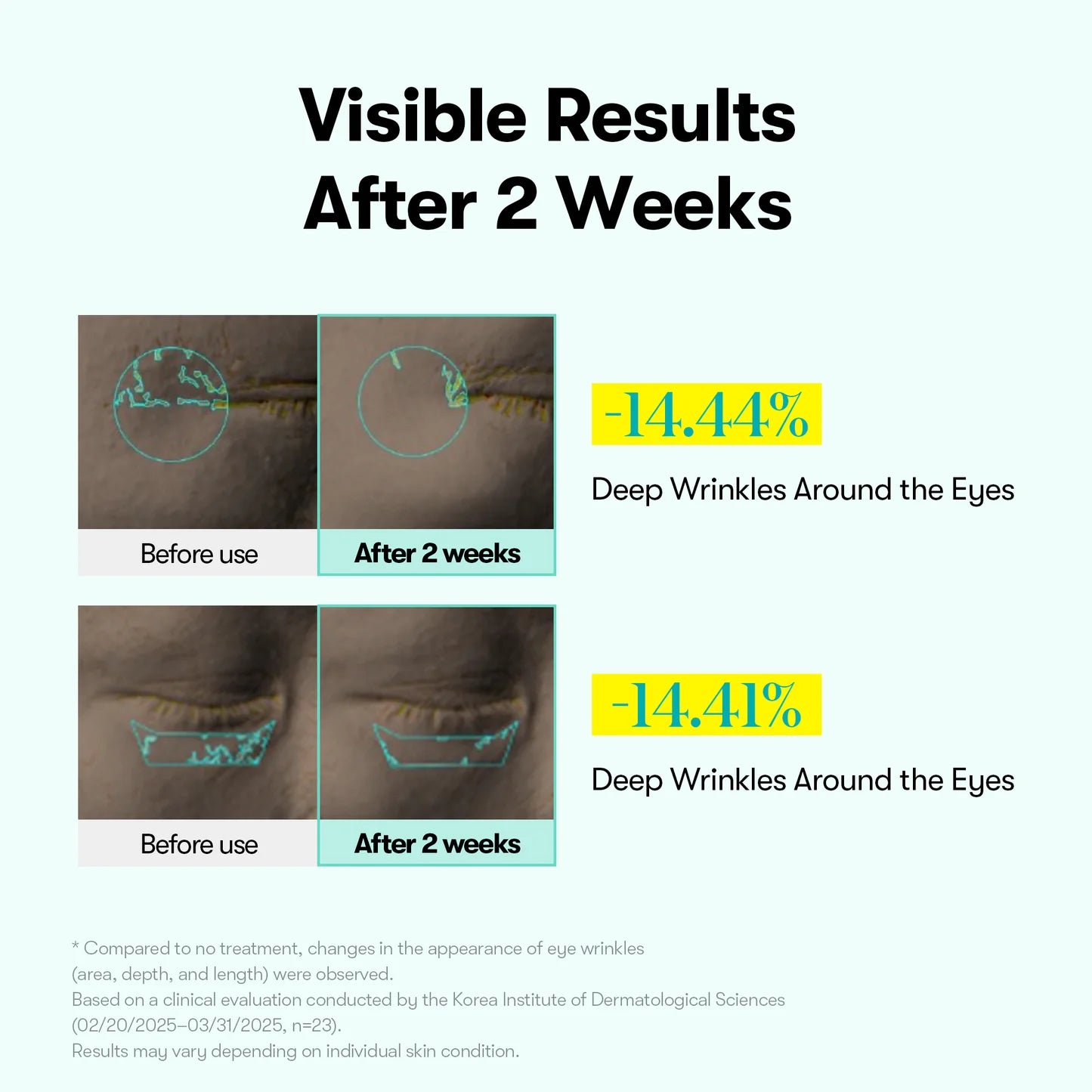 VT Cosmetics PDRN Reedle Shot Firming Eye Cream