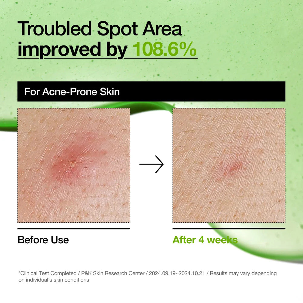ANUA Azelaic Acid 10 Hyaluron Redness Soothing Serum