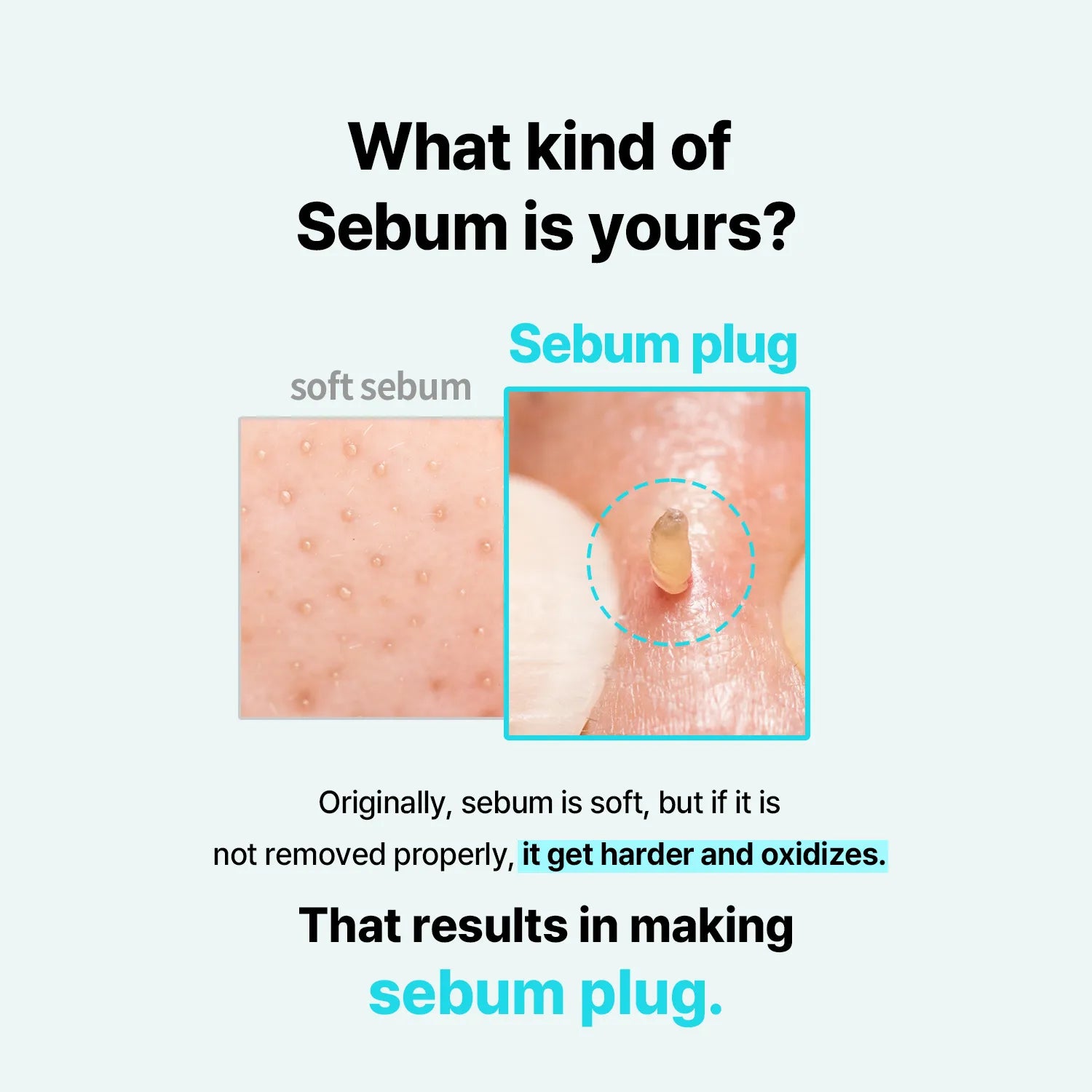 Ilso - Super Melting Sebum Softener + Cotton Pad